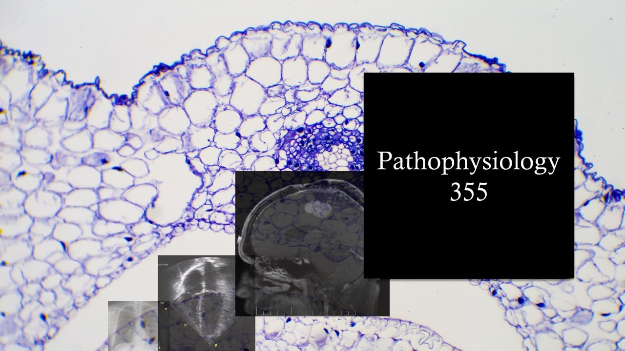 PHGY 350 - Pathophysiology