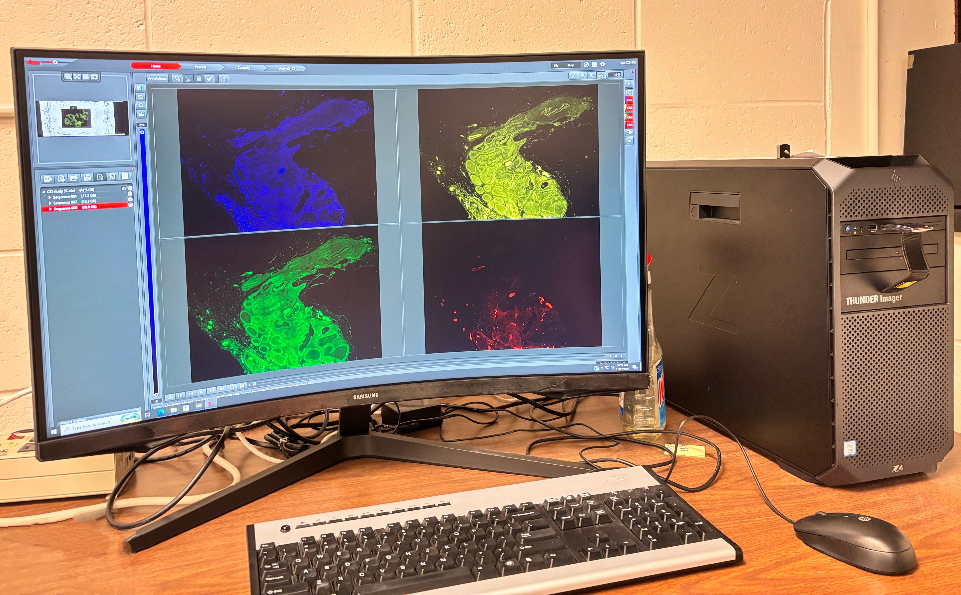 
                         Biomedical Image Analysis                                                    