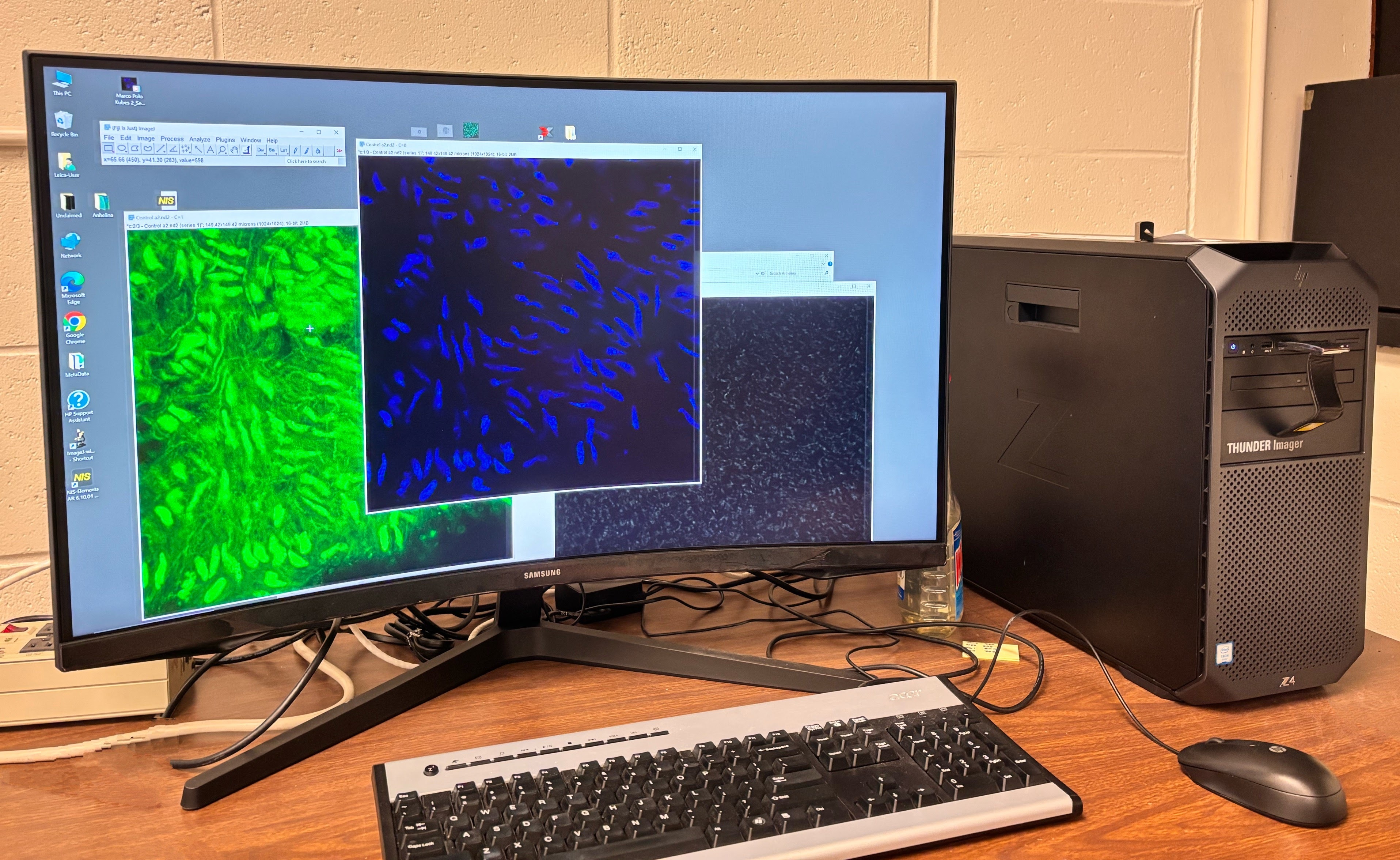 
                         Biomedical Image Analysis                                                    
